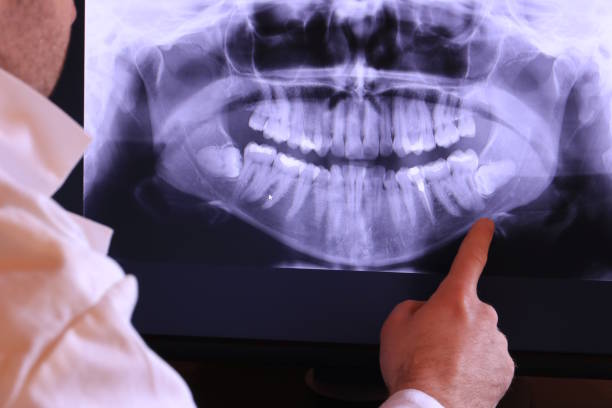Best Emergency Treatment for Jaw Pain or Injury in Lead, SD